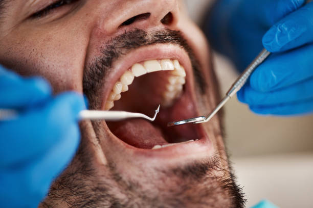 Best Emergency Treatment for Toothache in Emmon, AK